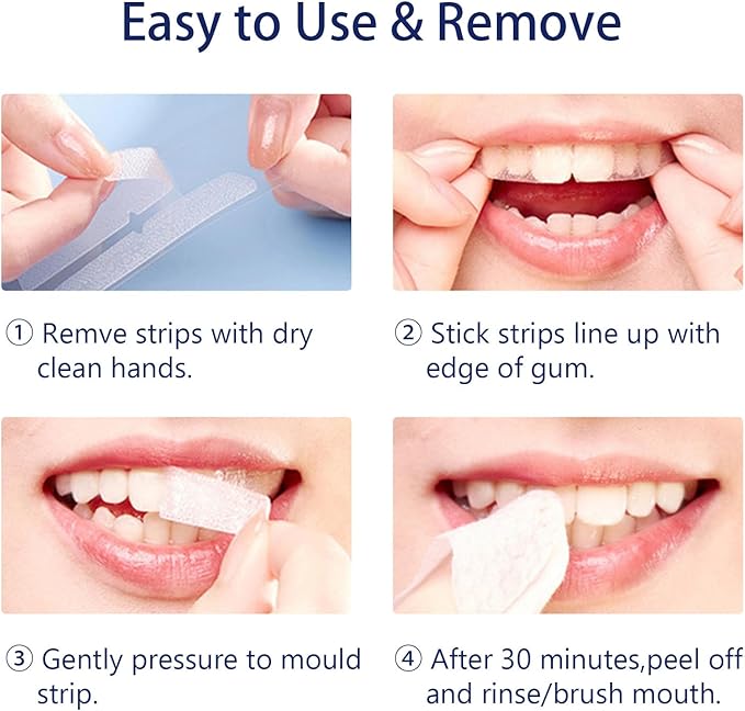 Teeth Whitening Strips